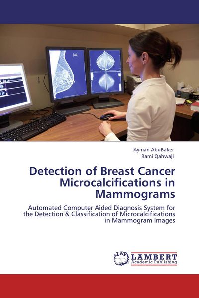 Produktbild: Detection of Breast Cancer Microcalcifications in Mammograms
