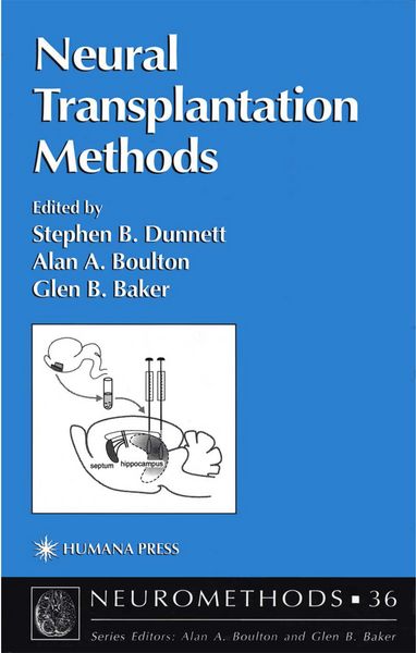 Produktbild: Neural Transplantation Methods