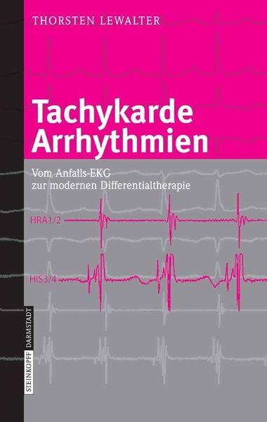 Produktbild: Tachykarde Arrhythmien