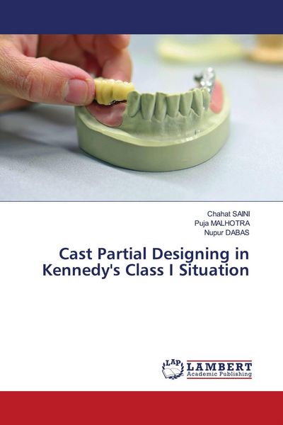 Produktbild: Cast Partial Designing in Kennedy's Class I Situation