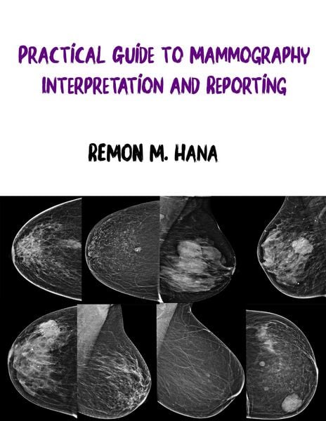Produktbild: Practical Guide to Mammography Interpretation and Reporting