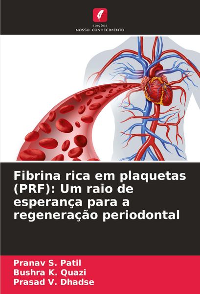 Produktbild: Fibrina rica em plaquetas (PRF): Um raio de esperan&ccedil;a para a regenera&ccedil;&atilde;o periodontal