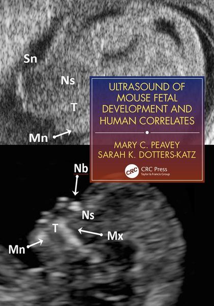 Produktbild: Ultrasound of Mouse Fetal Development and Human Correlates