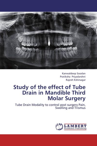 Produktbild: Study of the effect of Tube Drain in Mandible Third Molar Surgery