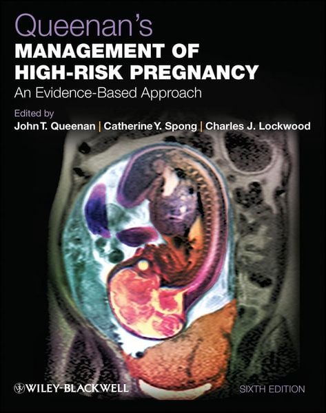 Produktbild: Queenan's Management of High-Risk Pregnancy