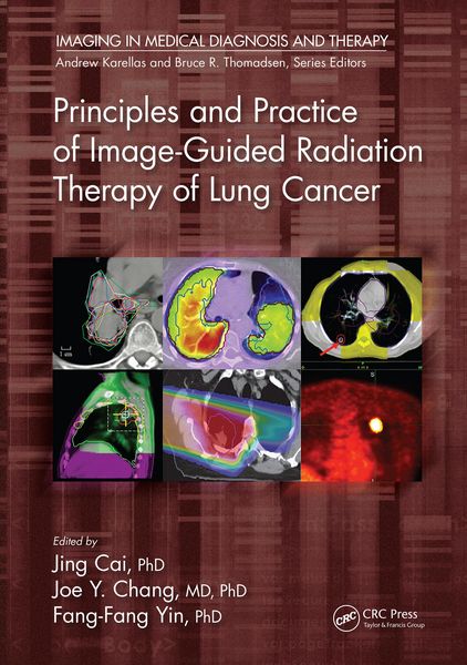 Produktbild: Principles and Practice of Image-Guided Radiation Therapy of Lung Cancer