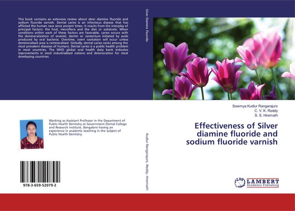 Produktbild: Effectiveness of Silver diamine fluoride and sodium fluoride varnish
