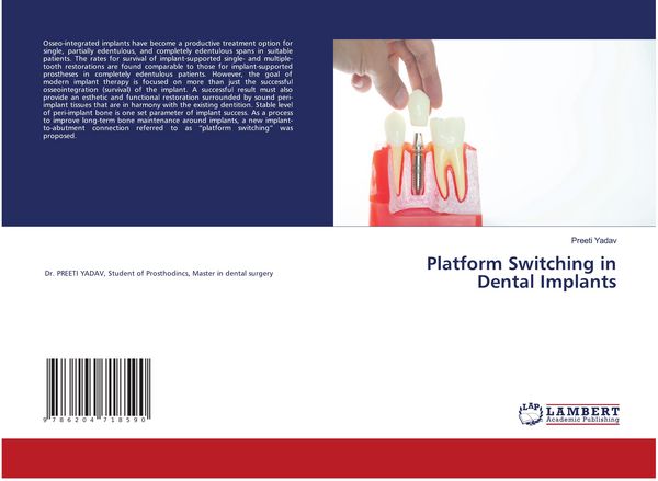 Produktbild: Platform Switching in Dental Implants