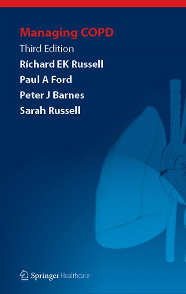 Produktbild: Managing COPD