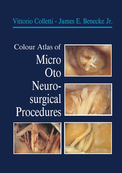 Produktbild: Colour Atlas of Micro-Oto-Neurosurgical Procedures