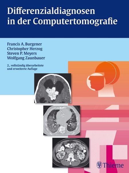 Produktbild: Differenzialdiagnosen in der Computertomografie