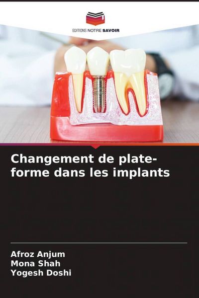 Produktbild: Changement de plate-forme dans les implants