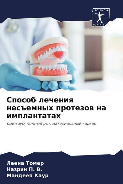 Produktbild: Sposob lecheniq nes#emnyh protezow na implantatah