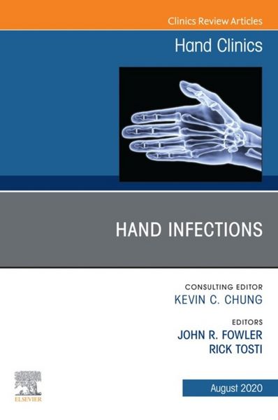 Produktbild: Hand Infections, An Issue of Hand Clinics