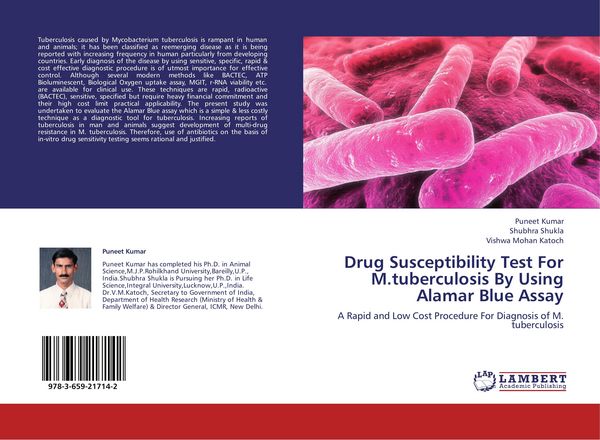 Produktbild: Drug Susceptibility Test For M.tuberculosis By Using Alamar Blue Assay