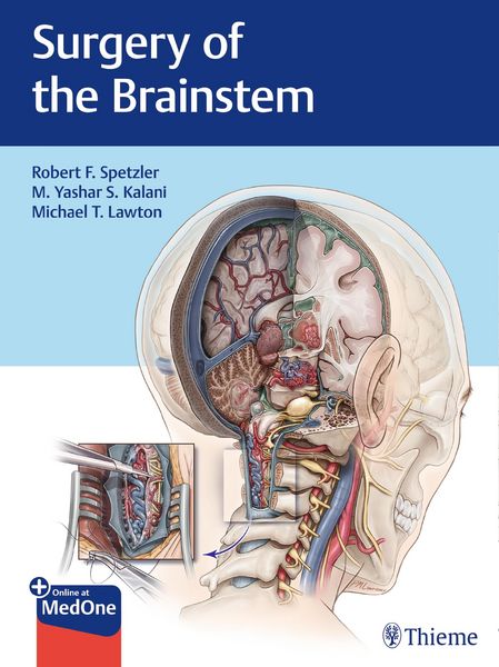 Produktbild: Surgery of the Brainstem