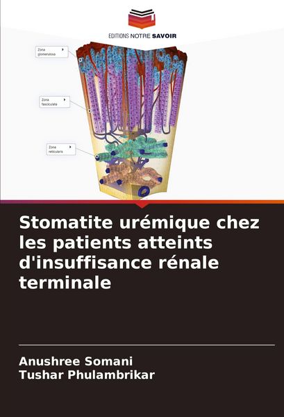 Produktbild: Stomatite ur&eacute;mique chez les patients atteints d'insuffisance r&eacute;nale terminale