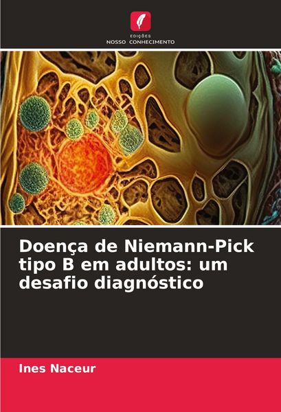 Produktbild: Doen&ccedil;a de Niemann-Pick tipo B em adultos: um desafio diagn&oacute;stico