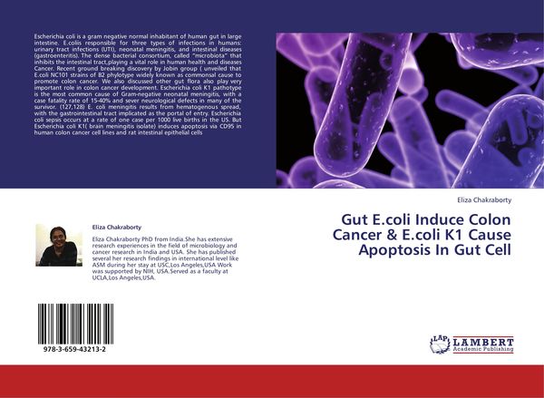 Produktbild: Gut E.coli Induce Colon Cancer & E.coli K1 Cause Apoptosis In Gut Cell