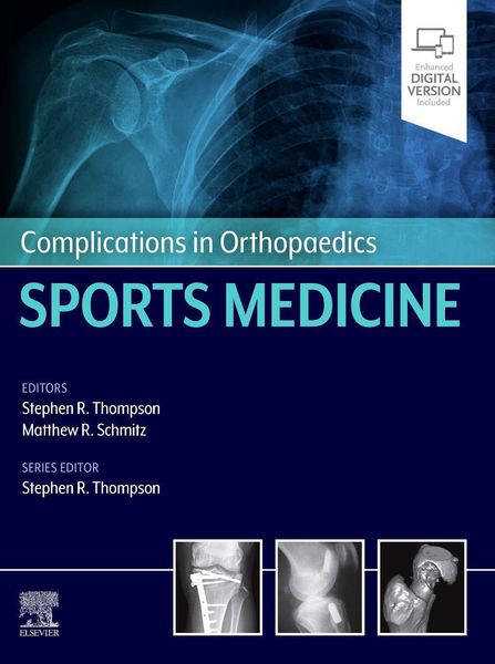 Produktbild: Complications in Orthopaedics: Sports Medicine