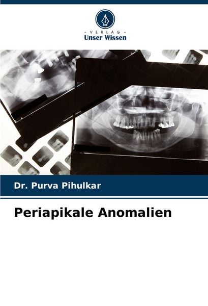 Produktbild: Periapikale Anomalien
