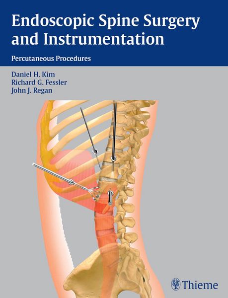 Produktbild: Endoscopic Spine Surgery and Instrumentation