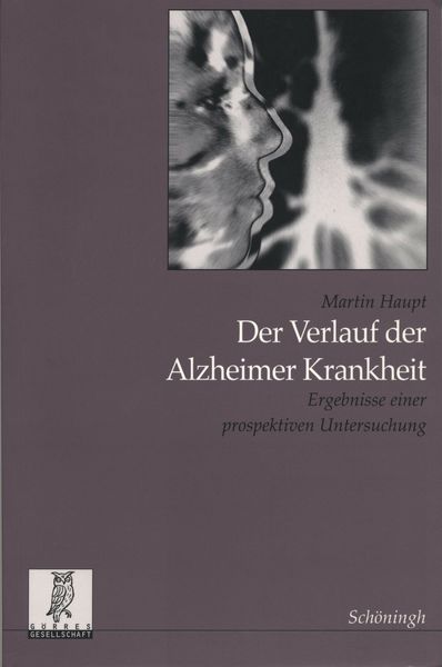 Produktbild: Der Verlauf der Alzheimer Krankheit
