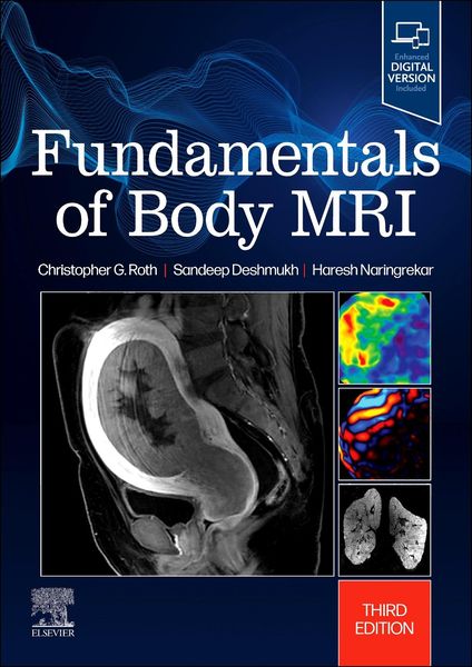 Produktbild: Fundamentals of Body MRI