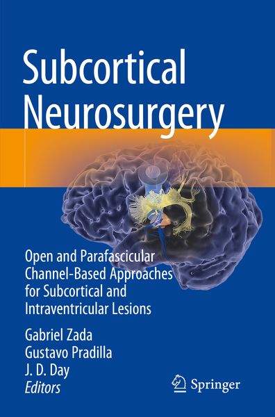 Produktbild: Subcortical Neurosurgery