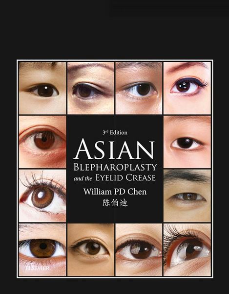 Produktbild: Asian Blepharoplasty and the Eyelid Crease E-Book