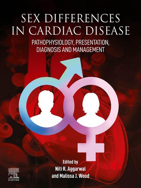 Produktbild: Sex differences in Cardiac Diseases