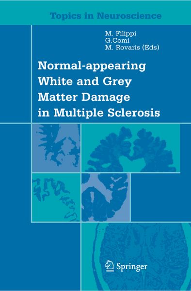 Produktbild: Normal-appearing White and Grey Matter Damage in Multiple Sclerosis