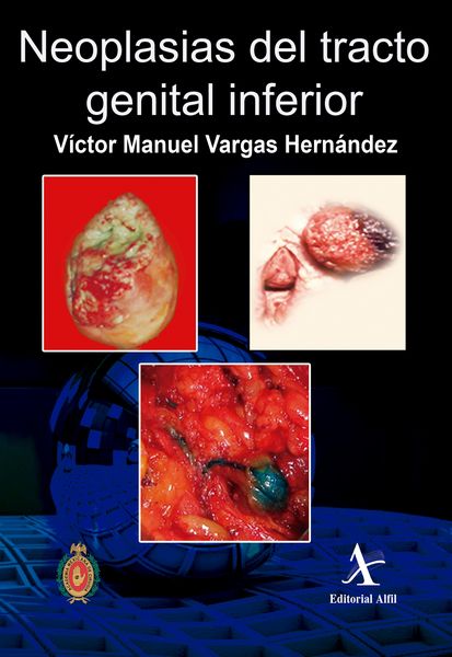 Produktbild: Neoplasias del tracto genital inferior