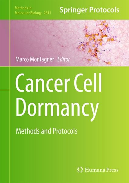 Produktbild: Cancer Cell Dormancy