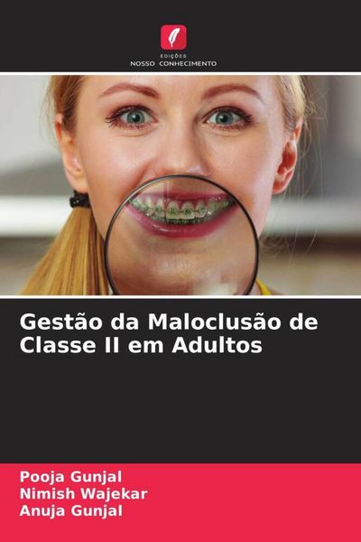 Produktbild: Gest&atilde;o da Maloclus&atilde;o de Classe II em Adultos