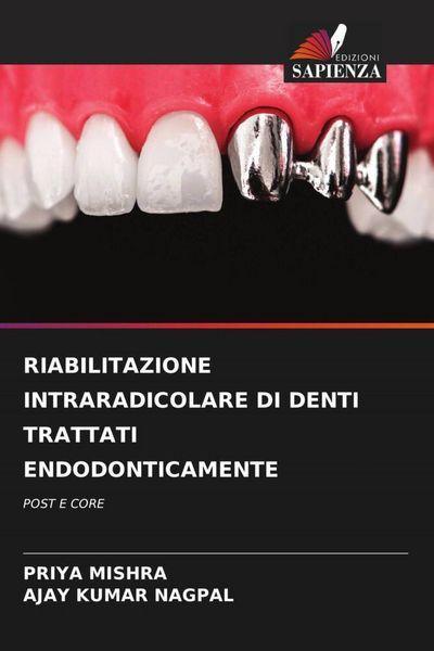 Produktbild: Riabilitazione Intraradicolare Di Denti Trattati Endodonticamente