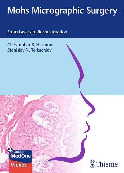 Produktbild: Mohs Micrographic Surgery: From Layers to Reconstruction