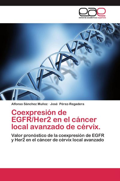 Produktbild: Coexpresi&oacute;n de EGFR/Her2 en el c&aacute;ncer local avanzado de c&eacute;rvix.