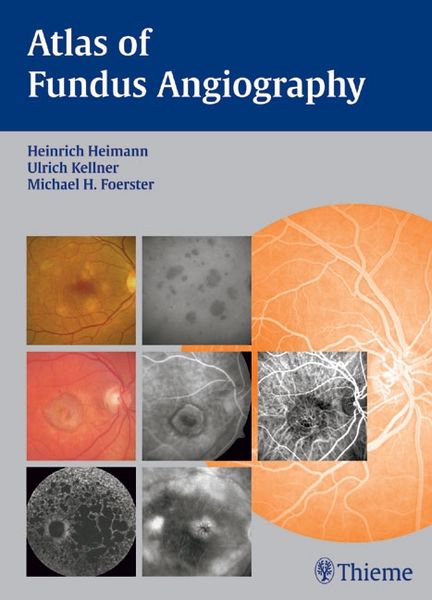 Produktbild: Atlas of Fundus Angiography