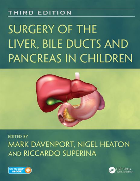Produktbild: Surgery of the Liver, Bile Ducts and Pancreas in Children