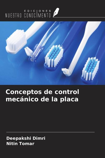 Produktbild: Conceptos de control mec&aacute;nico de la placa