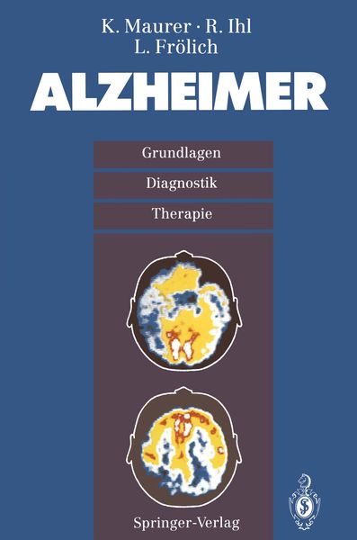 Produktbild: Alzheimer