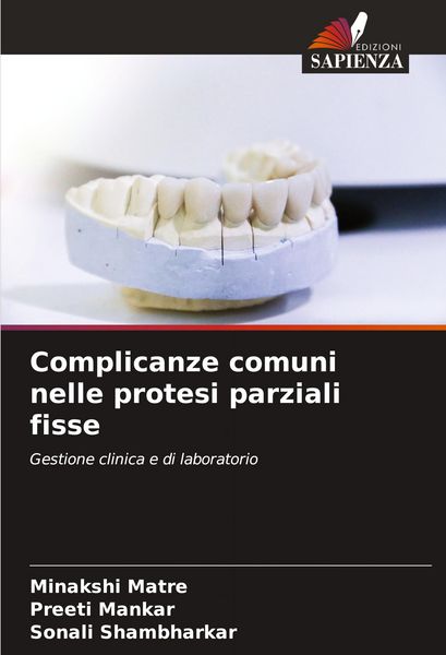 Produktbild: Complicanze comuni nelle protesi parziali fisse
