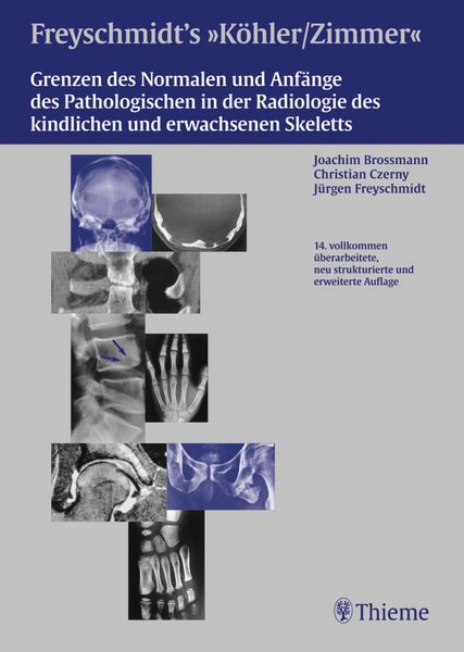 Produktbild: Freyschmidts K&ouml;hler/Zimmer: Grenzen des Normalen und Anf&auml;nge des Pathologischen