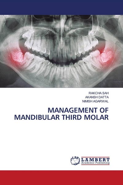 Produktbild: Management Of Mandibular Third Molar