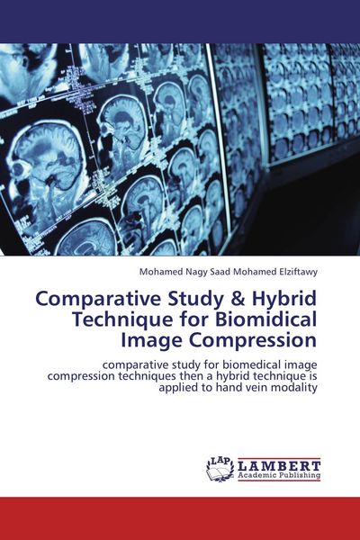 Produktbild: Comparative Study & Hybrid Technique for Biomidical Image Compression