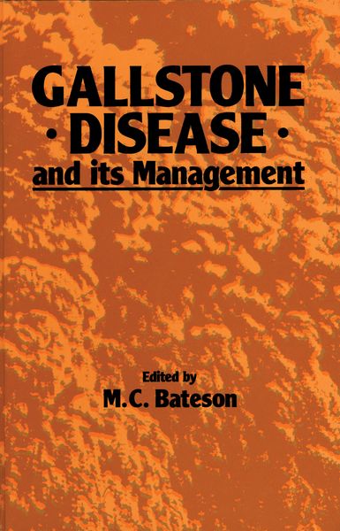 Produktbild: Gallstone Disease and its Management