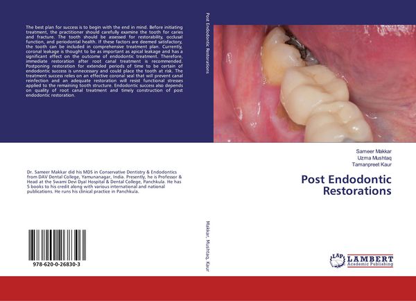 Produktbild: Post Endodontic Restorations