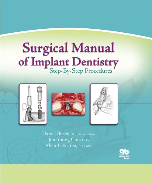 Produktbild: Surgical Manual of Implant Dentistry