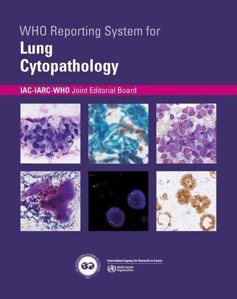 Produktbild: Who Reporting System for Lung Cytopathology